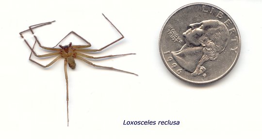 Click image for larger version

Name:	Live Brown Recluse Scan.jpg
Views:	14
Size:	78.7 KB
ID:	5273